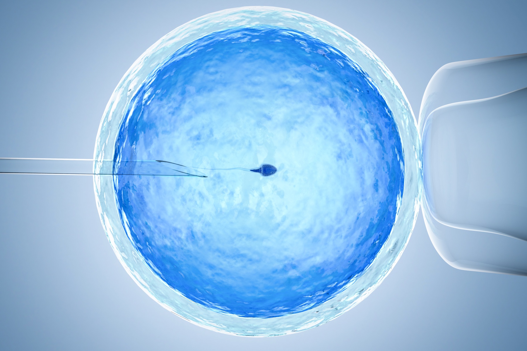 La Fécondation in Vitro ICSI