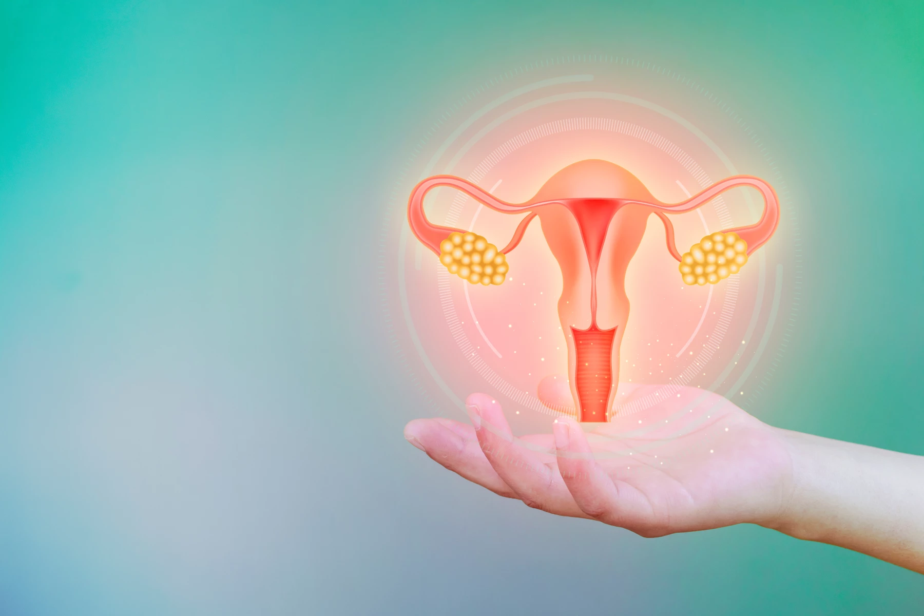 Syndrome des Ovaires Poly-Kystiques (SOPK) : qu'est ce que c'est ?