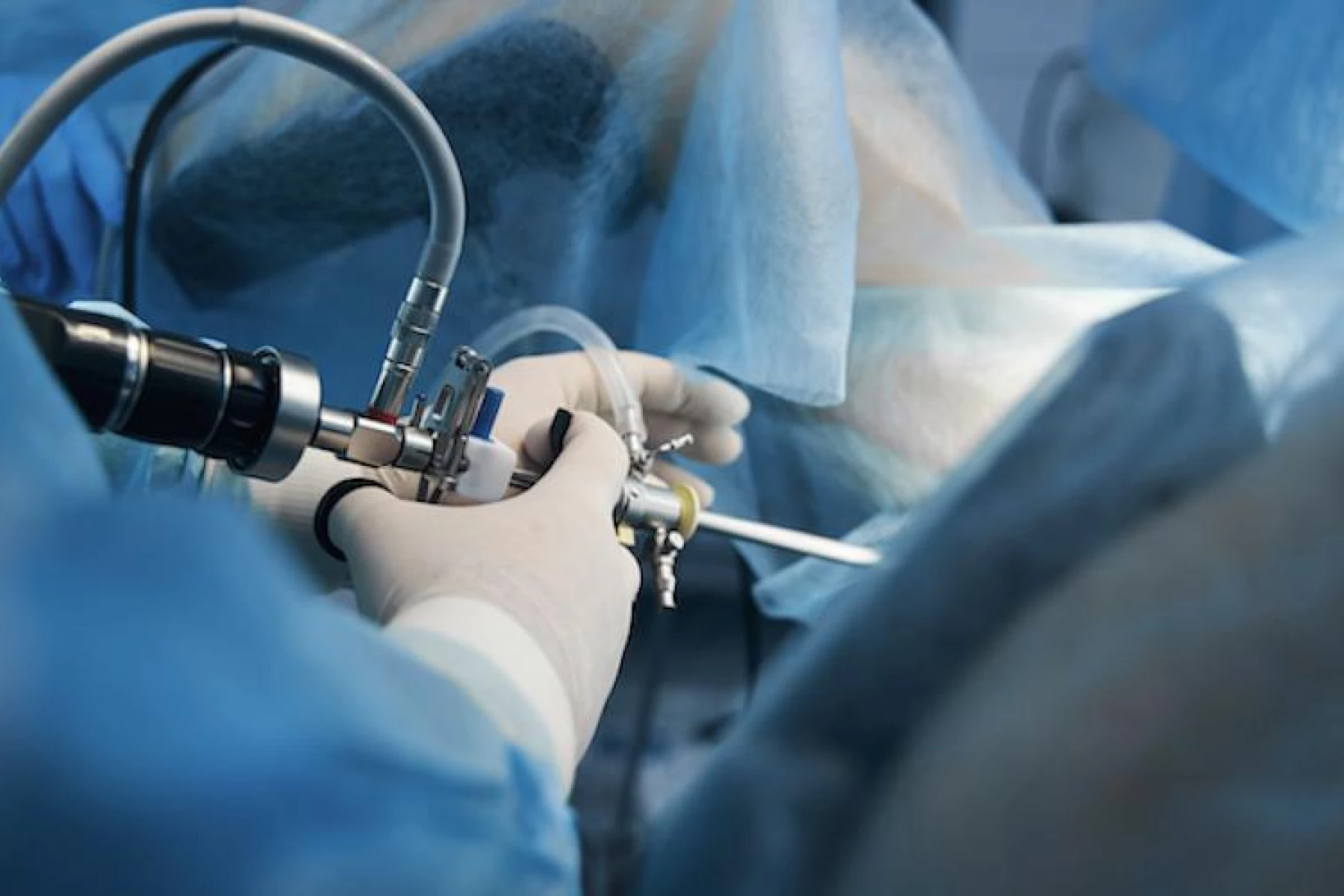 Hysteroscopy, Laparoscopy : Infertility Surgery | Wistim