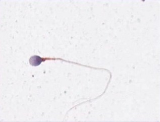 Spermocytogramme