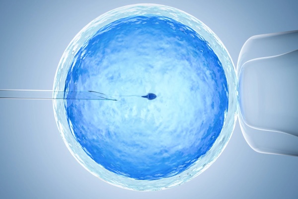 In Vitro Fertilisation ICSI