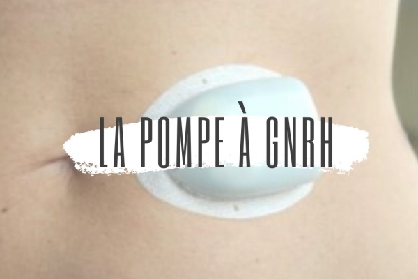 Pompe à GnRH pour traiter l'aménorrhée